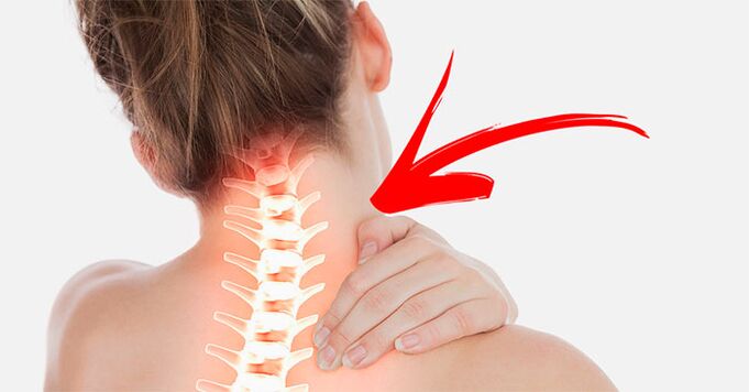 kaklo skausmas kodėl ir ką daryti